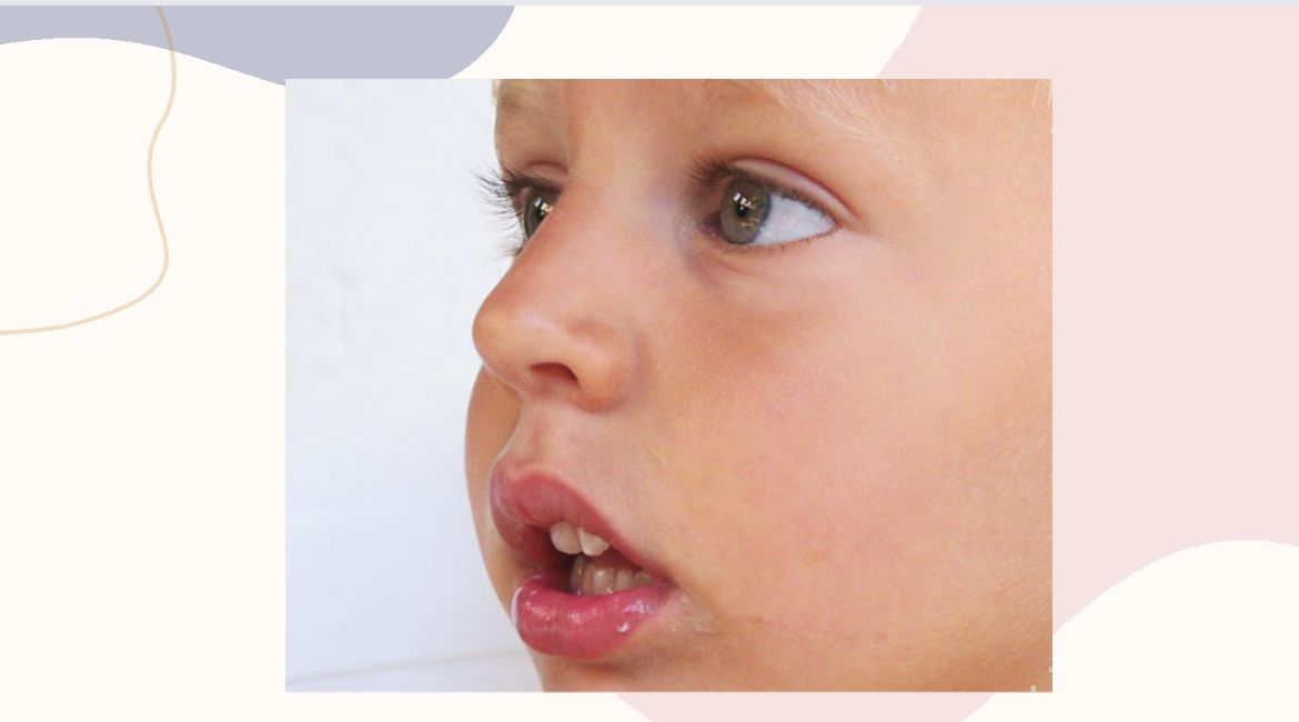 Respiração Oral em Crianças: Causas e Impacto na Saúde